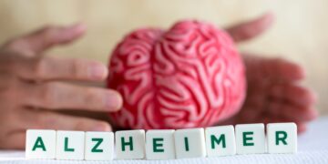 La Asociación de Alzheimer lo confirma: estos son las primeras señales
